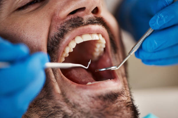 Best Emergency Dentist for Knocked-Out Tooth in Kuna, ID